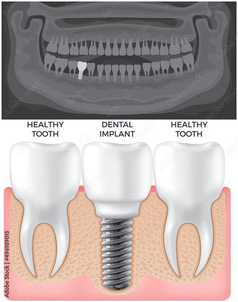 black  white  ray  jaw  human gum  normal teeth