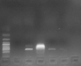 Electroforesis En Gel De Agarosa De La Rt Pcr Usando Un Control