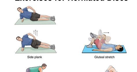 bicycle: Exercises for a Herniated Disc