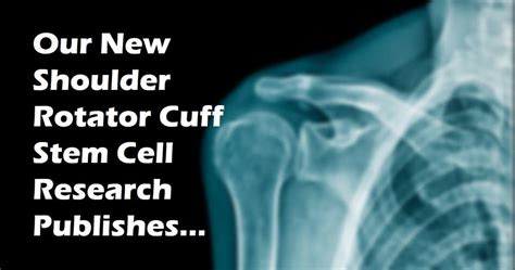 Rotator Cuff Stem Cell Treatment A Revolutionary Approach To Healing Martlabpro