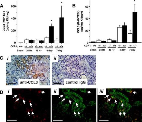 Ccl3 Mip 1 And Ccl5 Rantes Expression Are Up Regulated After Renal