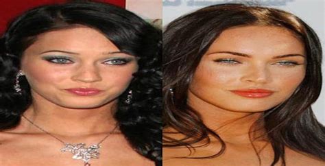 Worst Cases Of Celebrity Plastic Surgery Gone Wrong