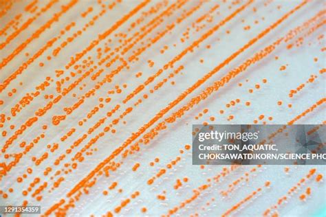 70 Bacterial Growth Media Stock Photos, High-Res Pictures, and Images ...