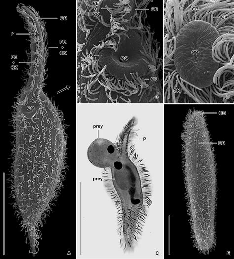 Morphological Diversity And Food Uptake In Free Living Litostomatean