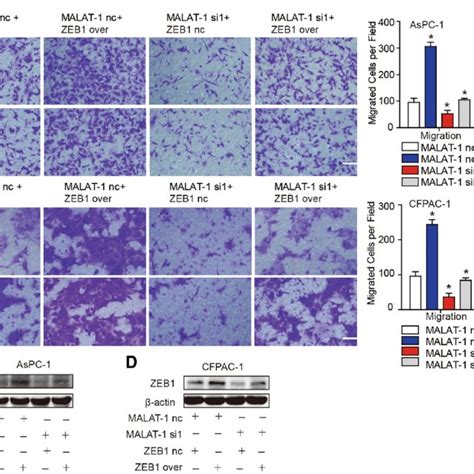 ZEB1 Overexpression Rescue The Loss Of MALAT 1 Mediated Reduced Cell