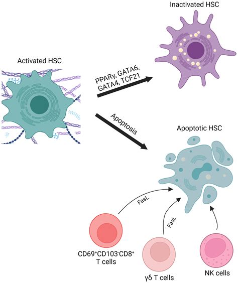 Hepatic Stellate Cells Dictating Outcome In Nonalcoholic Fatty Liver