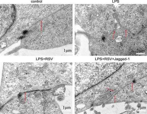 The Effect Of Notch Pathway Activation On The Tight Junction Structure