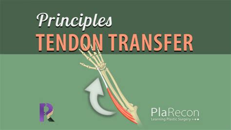 Tendon Transfer Principles Mnemonics