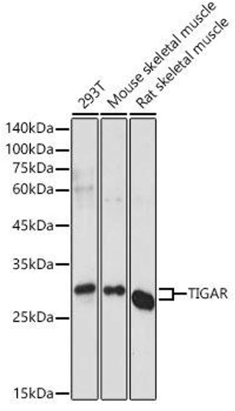 Anti Tigar 抗体 Assay Genie