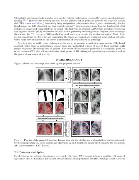 Deep Learning Based Lung Segmentation And Automatic Regional Template