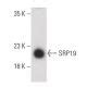 Anti Srp Antibody G Scbt Santa Cruz Biotechnology