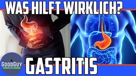 Was Hilft Wirklich Bei Gastritis Symptome Nat Behandlung