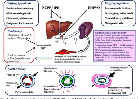 Figure 2 From Non Cirrhotic Portal Hypertension Semantic Scholar