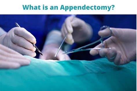 What Is An Appendectomy Appendicitis Laparoscopic Surgery