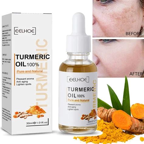 Turmeric Freckle Whitening Serum Face Brighten Curcumin Oil Fade Dark