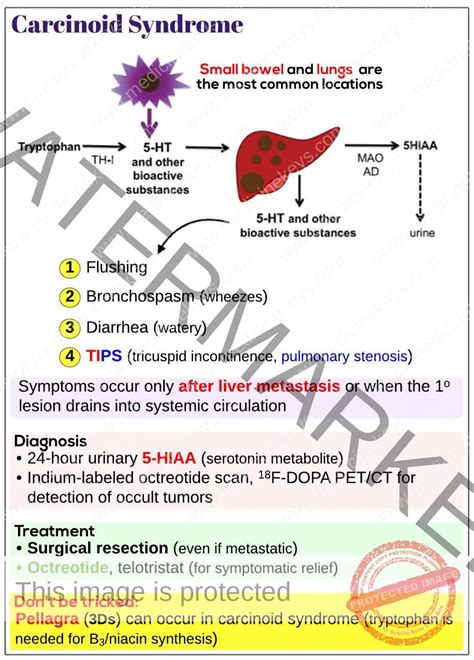 Carcinoid Syndrome Medicine Keys For Mrcps