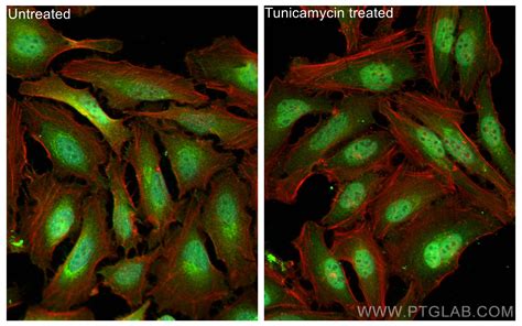 Atf4 Antibody 10835 1 Ap Proteintech