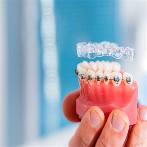 Invisalign Vs Braces A Complete Guide Antlara Dental Clinic