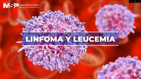 Dr Alexis Cruz Chacón Linfoma y leucemia YouTube