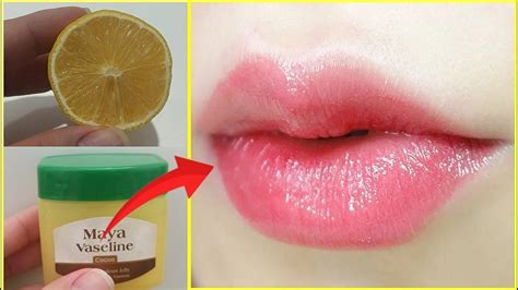 Get Baby Soft Pink Lips In Just 1 Day Naturally At Home Easy 100