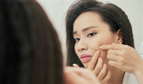 How to Safely Pop a Pimple, According to a Dermatologist | Skincare.com | Skincare.com