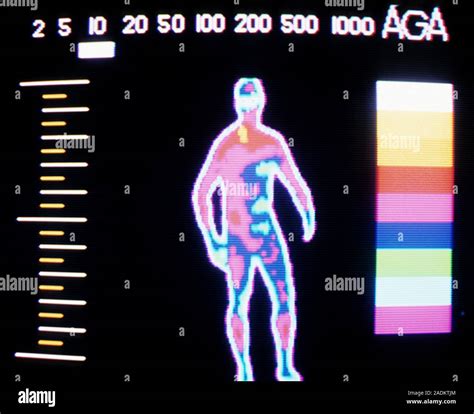 Thermogram Of A Man Thermogram Of The Body Of A Standing Man A