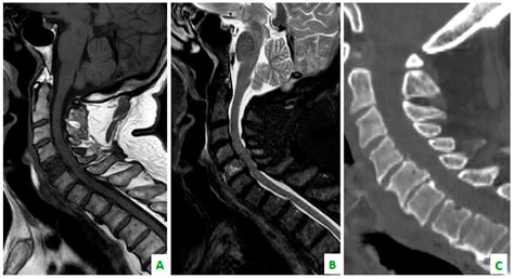 Diagnostics Free Full Text Whole Body Mri With Diffusion Weighted