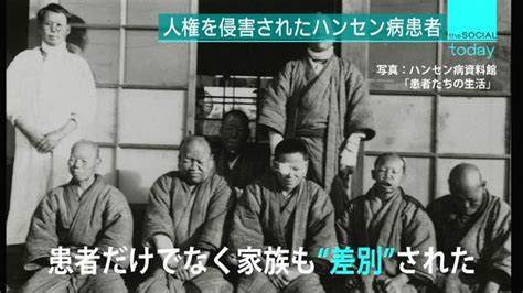 人権を侵害されてきた“ハンセン病”の歴史