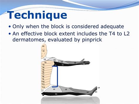 Ppt Segmental Thoracic Spinal Anesthesia Powerpoint Presentation