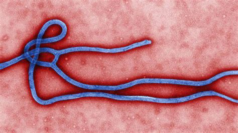 Ebola Virus and Disease