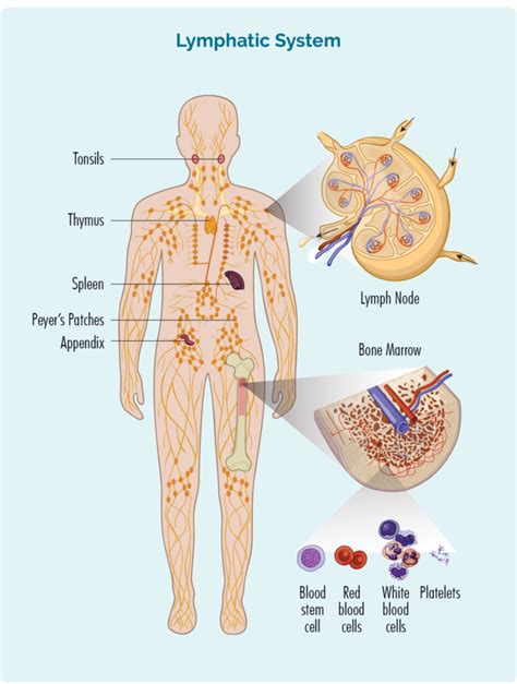 Hodgkin Lymphoma Lymphoma Australia