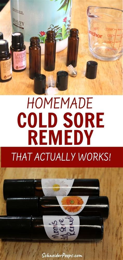 Make A Cold Sore Remedy That Actually Works