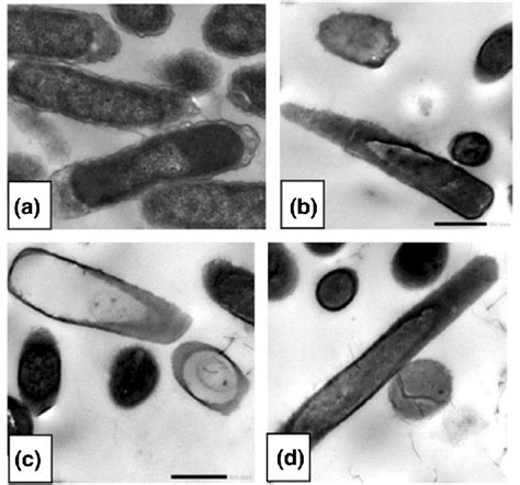 Tem Images Of E Coli A Untreated Cells Of E Coli And B D Treated