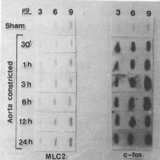 A Expression Of Mhc And C Myc Genes During The Development Of Cardiac