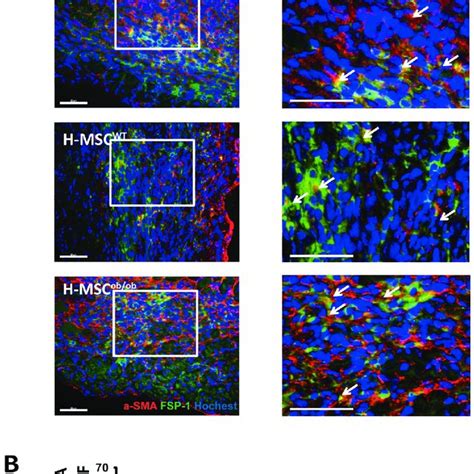 A Immunofluorescence staining of myofibroblast DAPI blue α SMA