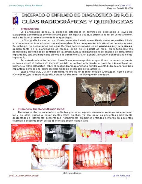 PDF Encerado o Enfilado de Diagnostico en ROI Guías Radiográficas y