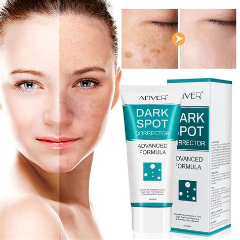 Dark Spot Corrector Cream for Face - Fade Black Precipitates, Remove