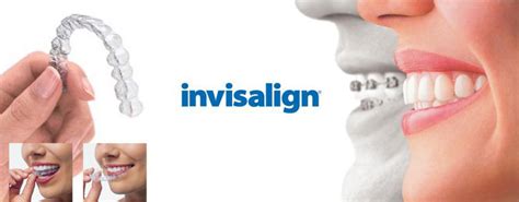 Invisalign Aligners The Modern Touch Dr Nechupadam Dental Clinic