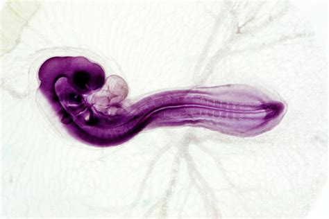 Chicken Embryo 1 Photograph By Dr Keith Wheelerscience Photo Library