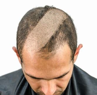 Buzz Cut Or Bald And Shaved Head: How To Choose • Ready Sleek