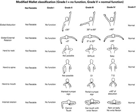 Brachial Plexus Injury Exercises