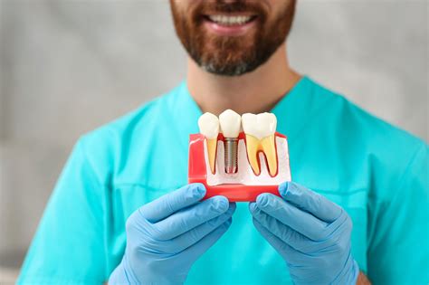 Dental Implant Care Tips For Long Term Success