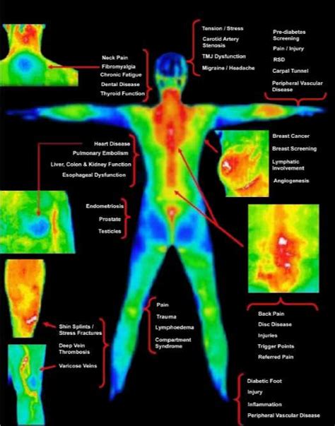 Thermography