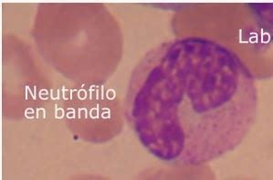 Fichero De Hematolog A Morfolog A Normal De Las C Lulas Sangu Neas