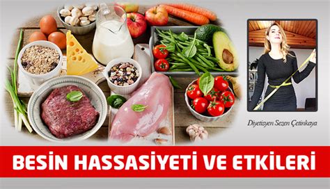 Sezen Etinkaya Besin Hassasiyeti Ve Etkileri New G Kt Rk Dergisi