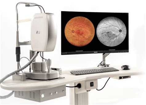 What Is Retinal Imaging