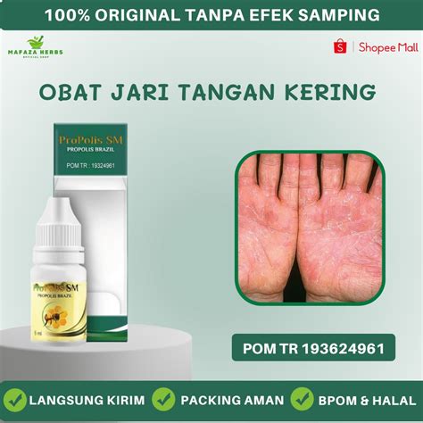 Jual Mafaza Herbs Obat Jari Tangan Kering Dan Pecah Obat Telapak