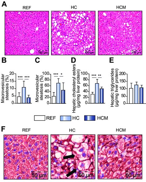 Mirtoselect Attenuates Hepatic Steatosis In Cholesterol Fed E3L Mice