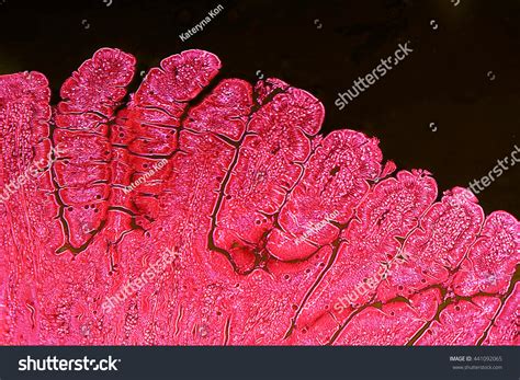 Villi Small Intestine Light Micrograph Enhanced Stock Photo Edit Now