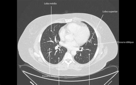 Atlas De Anatomia Radiologia Online